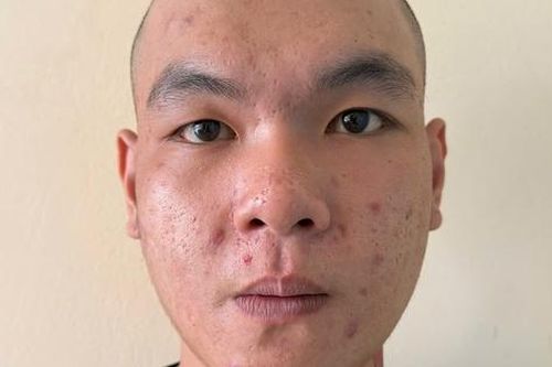 Trộm xe mô tô của cha ruột đem bán