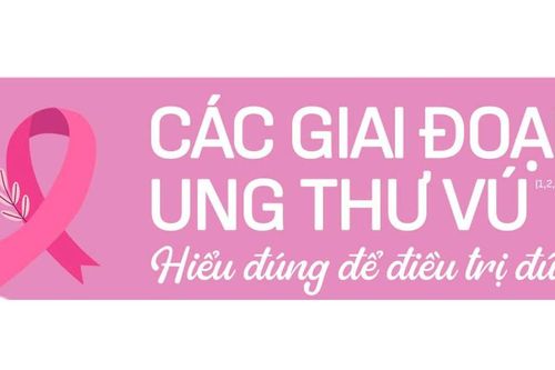 Ung thư vú: Hiểu đúng về các giai đoạn bệnh