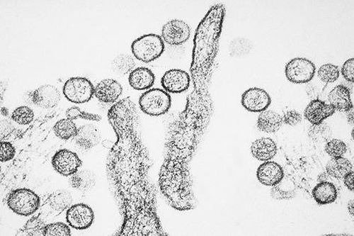 Bộ Y tế thông tin về bệnh do virus Hanta