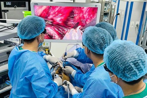 Mổ nội soi 3D thành công hai ca ung thư thực quản phức tạp với kỹ thuật khó