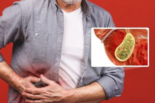 Cơn đau sỏi túi mật có nên mổ ngay?