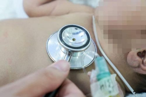 Kỳ tích cứu bé sơ sinh mang nhóm máu cực hiếm, lần đầu ghi nhận ở BV Nhi Trung ương
