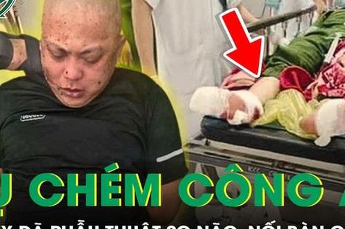 Đại úy công an bị chém tại trụ sở đã được nối lại bàn chân và phẫu thuật sọ não