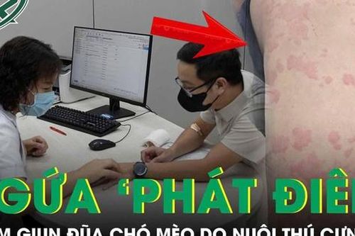 Ngứa 'phát điên', người đàn ông đi khám phát hiện nhiễm giun đũa chó mèo