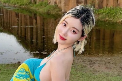 'DJ gợi cảm nhất Hàn Quốc' sau một năm bị hói