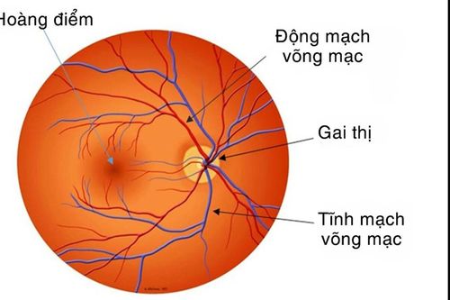 Tắc tĩnh mạch võng mạc