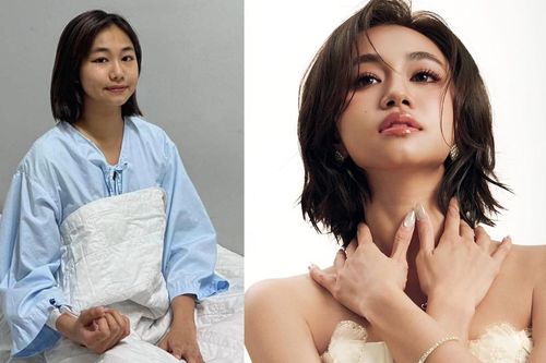 Sức khỏe hiện tại của diễn viên Ngân Hòa sau biến cố suy thận giai đoạn cuối