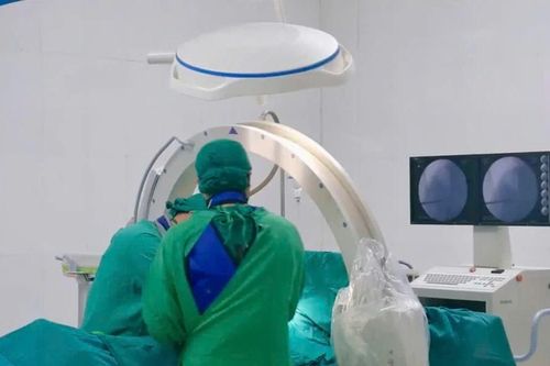Giảm đau kỳ diệu sau bơm xi măng sinh học