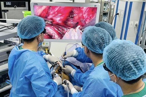 Phẫu thuật nội soi 3D đa vùng, bước tiến trong điều trị ung thư thực quản