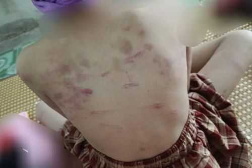 Vụ nữ sinh lớp 4 ở Cao Bằng bị đánh: Người mẹ dân tộc Nùng học hết lớp 7 mong con được bảo vệ