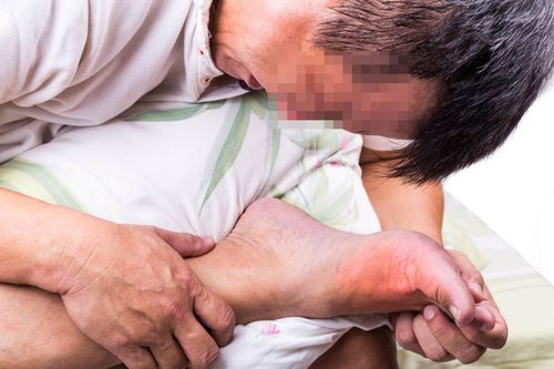 Cứ nghĩ bong gân nên tự xoa bóp, người đàn ông 38 tuổi ngỡ ngàng khi biết bị gout