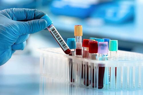 Xét nghiệm máu tại nhà tiện nhưng tiềm ẩn rủi ro: Bác sĩ chỉ ra điều nhiều người chủ quan
