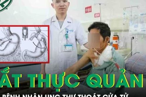 Người đàn ông phải cắt thực quản để điều trị ung thư