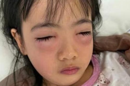 Chơi bong bóng xà phòng, bé 5 tuổi nguy kịch phải cấp cứu, sự thật khiến mẹ 'sốc nặng'