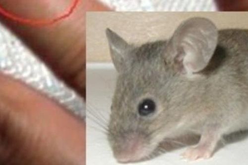 Chuột cắn gây nguy hiểm gì, cách nhận biết và xử trí đúng