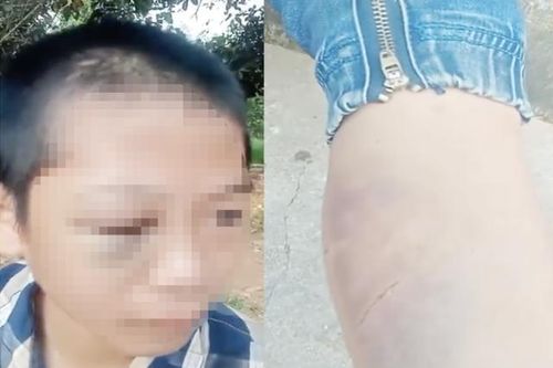 Xôn xao clip học sinh lớp 6 nghi bị người thân bạo hành
