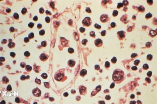 Việt Nam giám sát dịch bệnh tại cửa khẩu, phối hợp với WHO để phòng virus Hanta