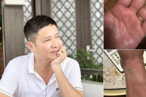 NSƯT Chí Trung tiết lộ mắc bệnh lạ gây ngứa ngáy khắp cơ thể. mất ngủ triền miên