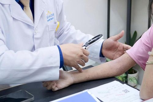 Cô gái phải đi khám gấp sau buổi đi bơi vì nổi mẩn đỏ khắp người