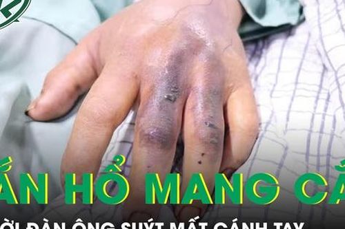 Đi làm ruộng bị rắn hổ mang cắn, người đàn ông suýt mất cánh tay
