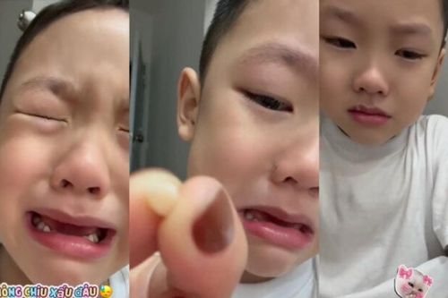 Phản ứng của con trai ca sĩ Phan Đinh Tùng khi gặp sự cố rụng răng đầu đời