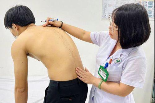 Tưởng đau lưng do tập gym, chàng trai 20 tuổi mắc viêm cột sống dính khớp