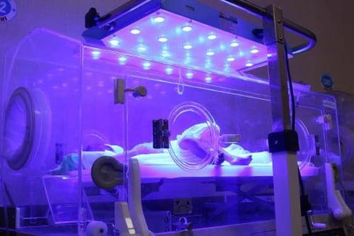 42 ngày giành giật sự sống cho bé sinh non 28 tuần tuổi