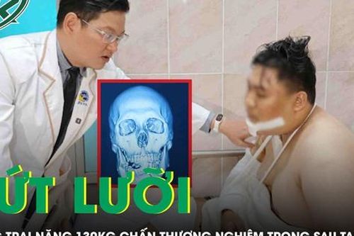 Cứu chàng trai nặng 130 kg đứt lưỡi sau tai nạn giao thông