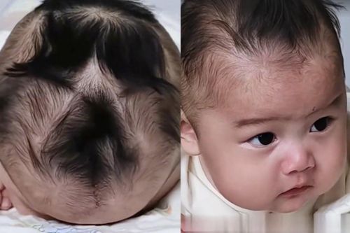 Bé trai có 9 xoáy tóc cực hiếm gặp