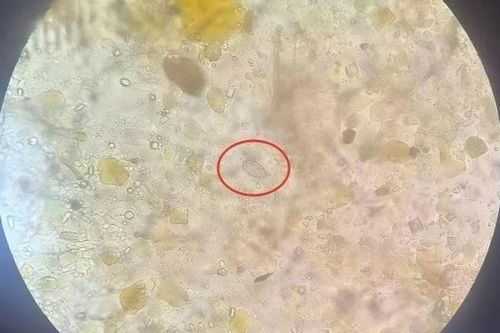 Ăn món khoái khẩu trong chuyến du lịch, người đàn ông 40 tuổi 'sốc nặng' khi đến bệnh viện khám