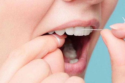 Những ai đang dùng chỉ nha khoa cần đặc biệt lưu ý điều này
