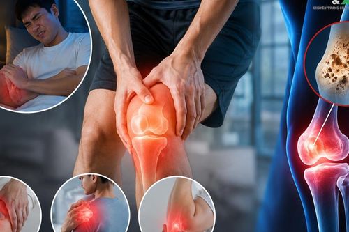Đau xương về đêm ngày càng nhiều, dấu hiệu cảnh báo không nên bỏ qua