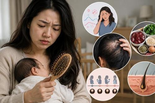 Rụng tóc sau sinh kéo dài: Khi nào không còn bình thường?