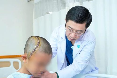 Phẫu thuật sọ não thức tỉnh cho bệnh nhi 12 tuổi mắc u não lớn, nguy hiểm