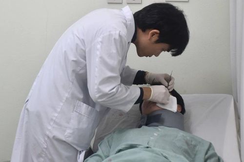 Tiêm filler tạo hình tai, 3 năm sau cô gái 24 tuổi nhập viện vì áp xe