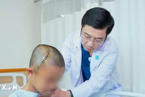 Thực hiện thành công ca phẫu thuật não tỉnh ở trẻ em đầu tiên tại Việt Nam
