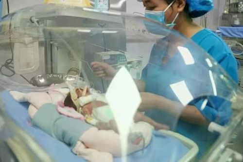 Nuôi sống thành công bé sinh non cực nhẹ cân 600 gram: Kỳ tích giữa đời thực