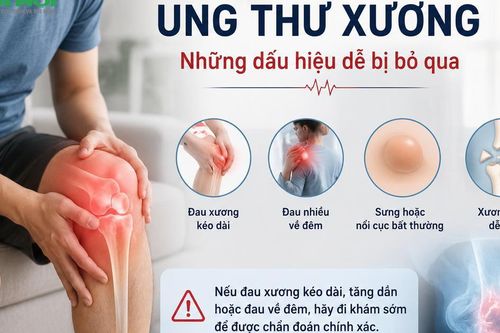 Đau xương kéo dài, đau nhiều về đêm: Bác sĩ cảnh báo dấu hiệu ung thư xương dễ bị bỏ qua