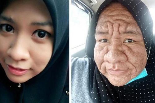Cô gái 28 tuổi bỗng 'già như cụ bà' U80: Bí ẩn phía sau gây bất ngờ