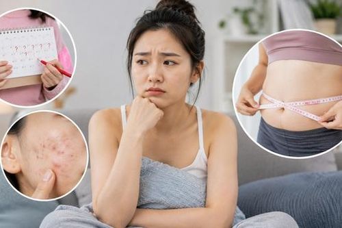 Dấu hiệu buồng trứng đa nang dễ bị bỏ qua
