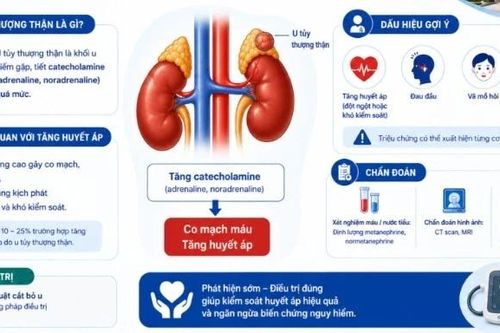 U tủy thượng thận- nguyên nhân nguy hiểm gây tăng huyết áp, đột quỵ