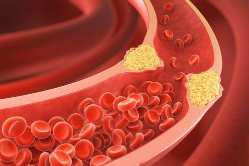 5 tín hiệu cảnh báo máu trong cơ thể quá đặc