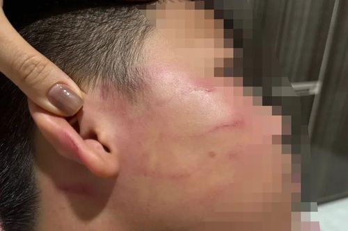 Vụ học sinh lớp 4 bị tát ở Gia Lai: Điểm dạy thêm hoạt động không phép
