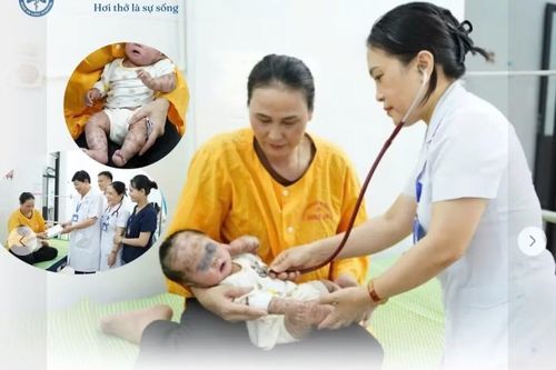 Cảnh báo biến chứng hô hấp nguy hiểm ở trẻ mắc bệnh vảy cá
