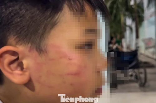 Tin mới vụ giáo viên người nước ngoài tát vào mặt học sinh