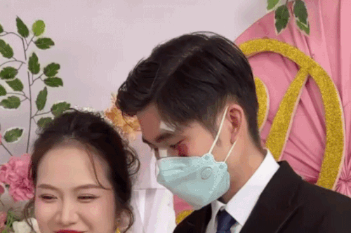 Chú rể đeo khẩu trang che mặt đầy vết thương trong ngày cưới