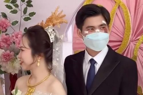 Chú rể đeo khẩu trang che mặt đầy vết thương trong ngày cưới
