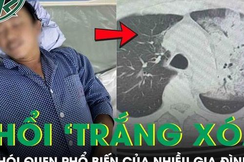 Tưởng cảm cúm, người đàn ông bất ngờ suy đa tạng, phổi 'trắng xóa' vì thói quen nhiều người mắc