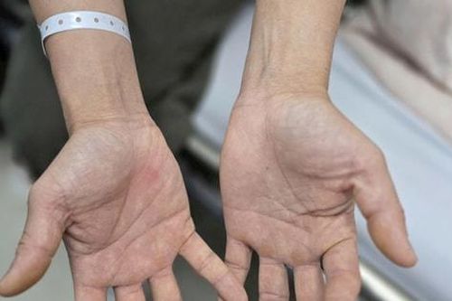 'Bóng cười' và cái giá đắt sau những cuộc vui ngắn ngủi