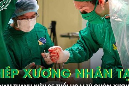 Ghép xương nhân tạo cho nam thanh niên 25 tuổi bị hoại tử chỏm xương đùi